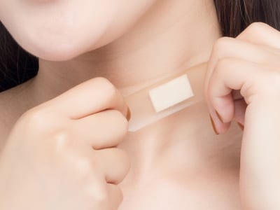 伤口处理胶黏剂应用